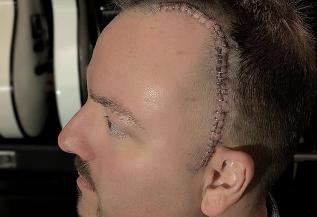 HATEBREED's WAYNE LOZINAK Is 'Getting Better Every Day' After Undergoing Operation To Remove Benign Brain Tumor